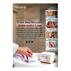 glowxin-crack-heel-recovery-cream.webp