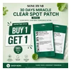 glowxin-some-by-mi-30-days-miracle-clear-spot-patch-18pcs.webp